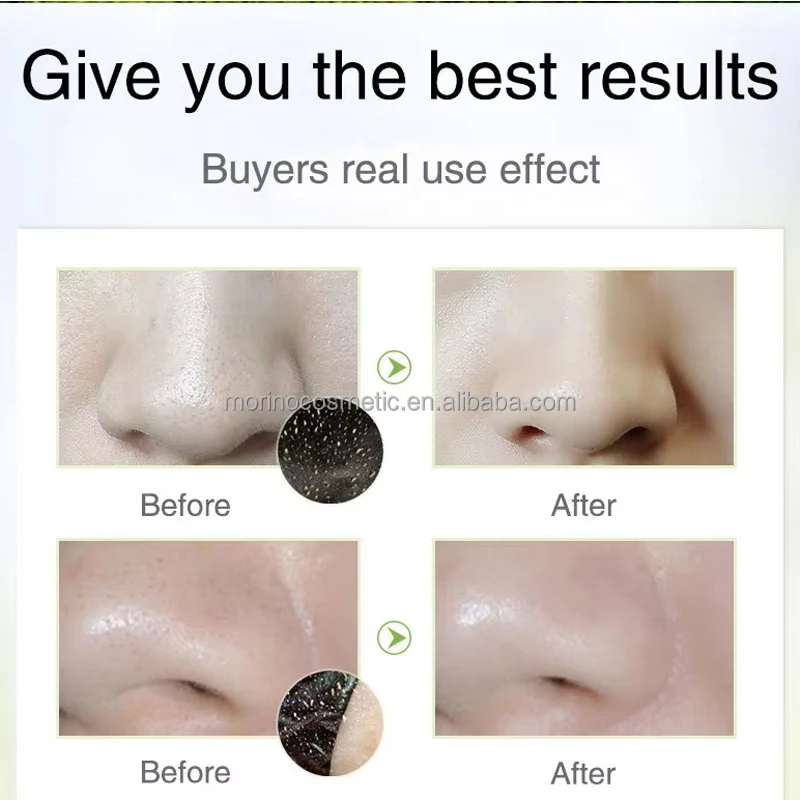 OEM ODM Deep Cleansing Charcoal Blackhead Removal Peel Off Mask Black Mask Facial Peel Off Face Mask