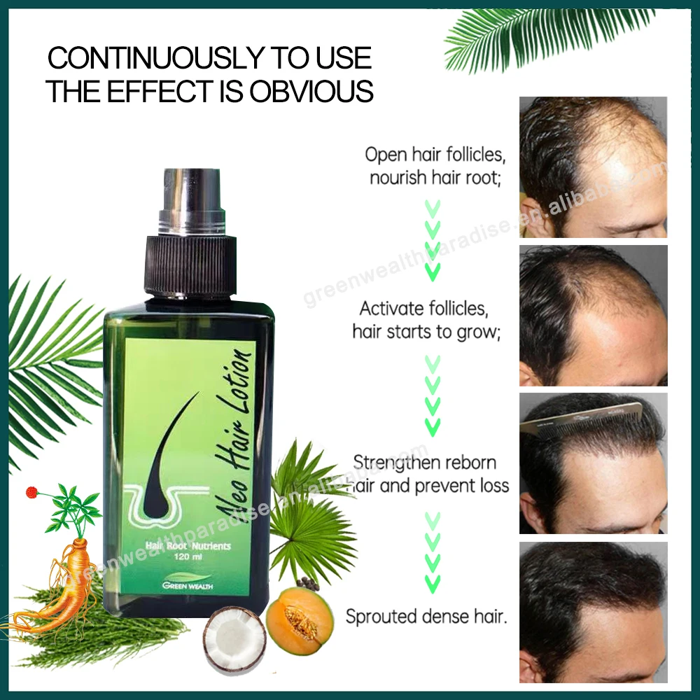 Daily use herbal Thailand Neo Hair Lotion 120ml Anti Hair Loss lotion hair growth spray