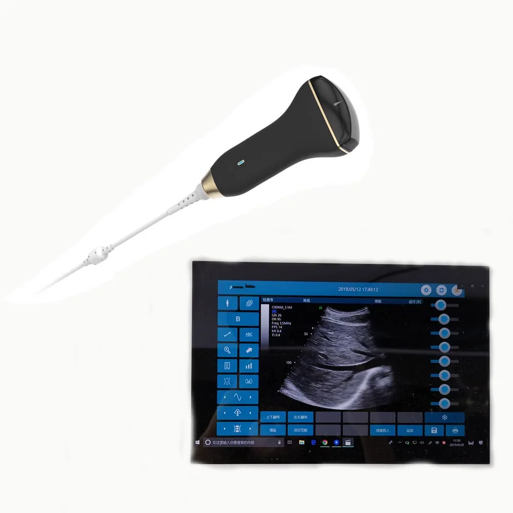 
GYGN - Portable Medical Ultrasound Instruments Convex Doppler Ultrasound Best Price 
