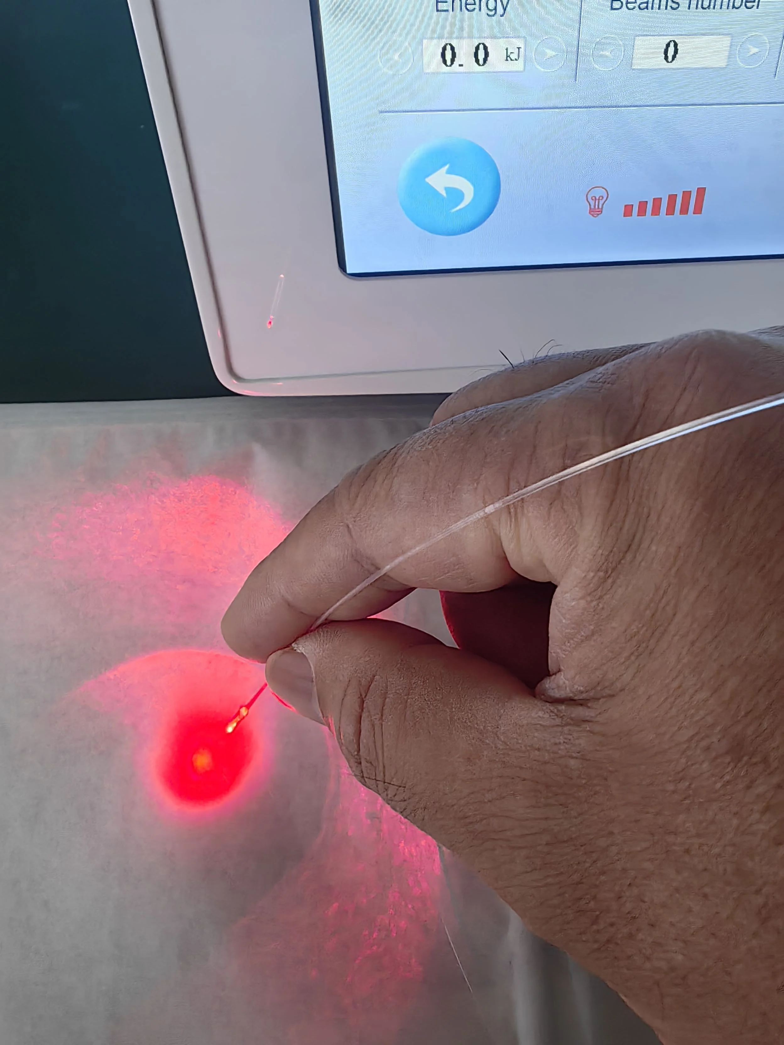 Hospital Use Laser Hemorrhoid Anesthesiologist Doctor Proctoscope 980 1470nm Equipment