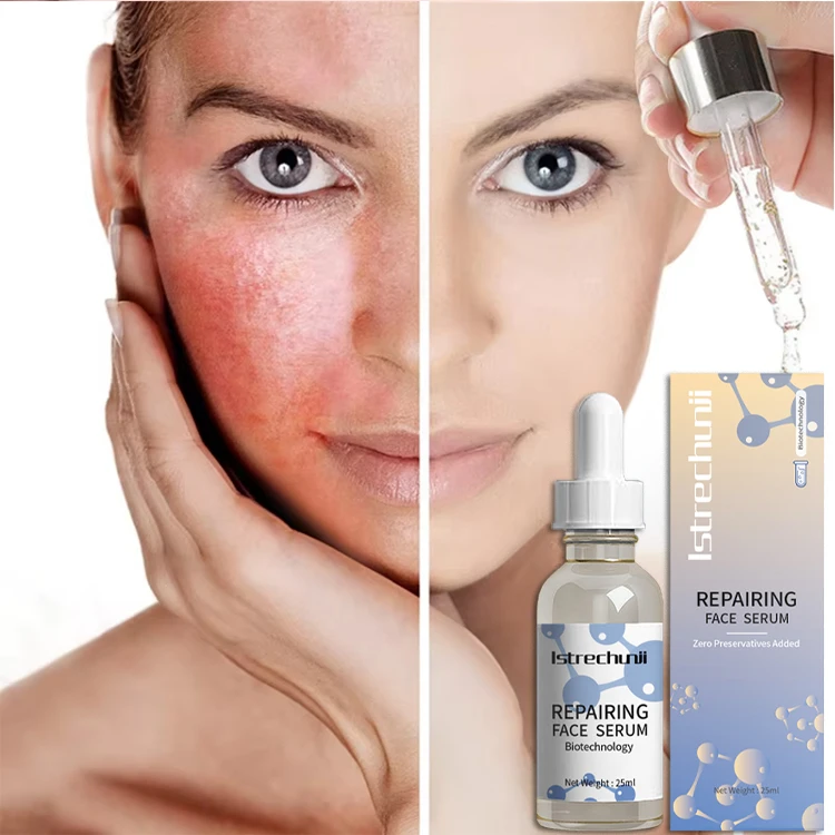 FGF Growth Factor Microbial Fermentation Skincare Anti-Aging Anti-Wrinkle Whitening Nourishing Collagen Serum Face Essence