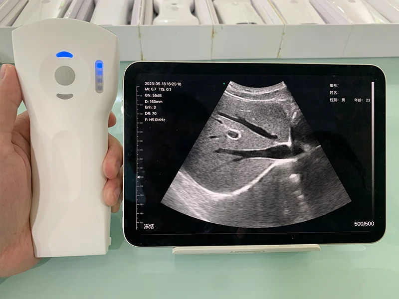 Emergency Ultrasound Device