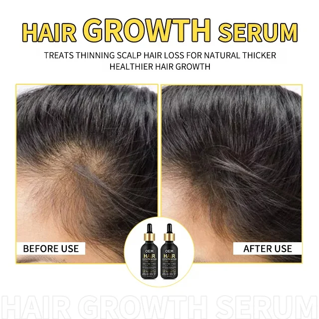 rosemary hair growth essential oil manufacturer 100% organic pure private label 120 ml Multi-use massage oils rosemary oil