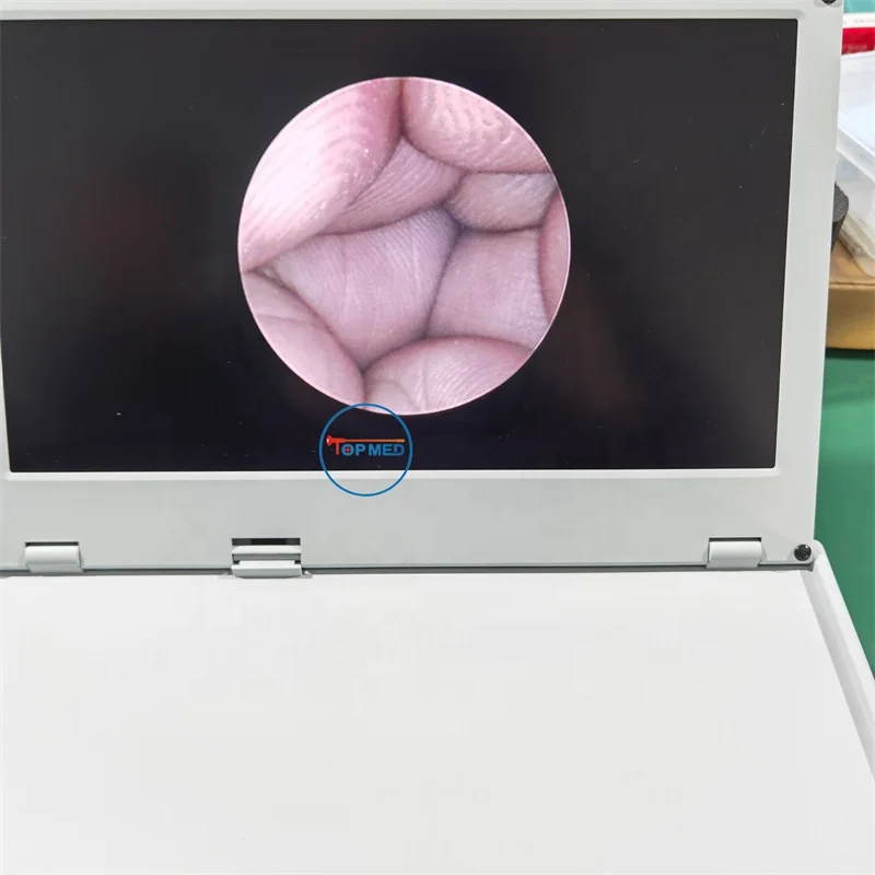 FHD Endoscopy Camera HD Unit Portable endoscope camera system for Laparoscopy Hysteroscopy Urology ENT Arthroscopy