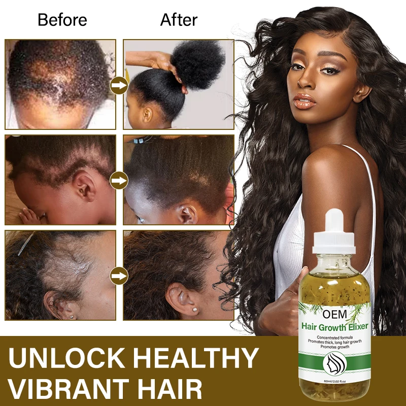 Customised Herbal Blend Rosemary Infusion Extreme Hair Growth Scalp Massage Oil Mint Castor Anti Alopecia Hair Strengthening Oil