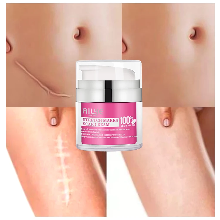 100% Effective Best Collagen Jojoba Oil Stretch Mark Cream Removal Scar Cream Nourish Intensive Treatment Stretch Mark Cream