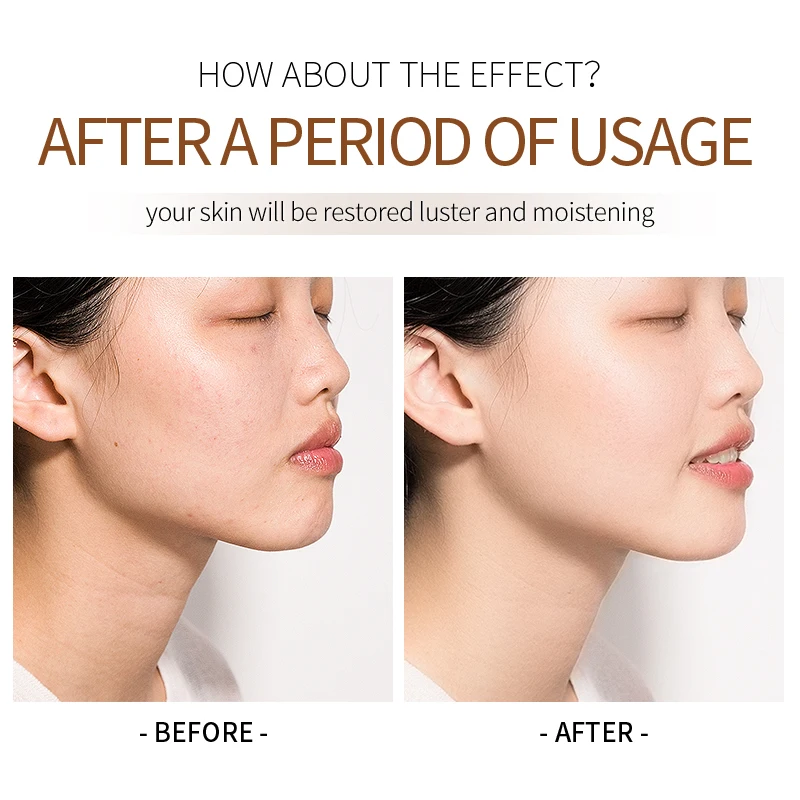 Organic Lanolin Facial Anti-Wrinkle Moisturiser 50g Skin Cream Niacinamide Hyaluronic Acid Herbal Effective Face Care