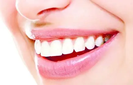 78% nickel base Dental Ni Cr Alloy for Lab Porcelain price per kg