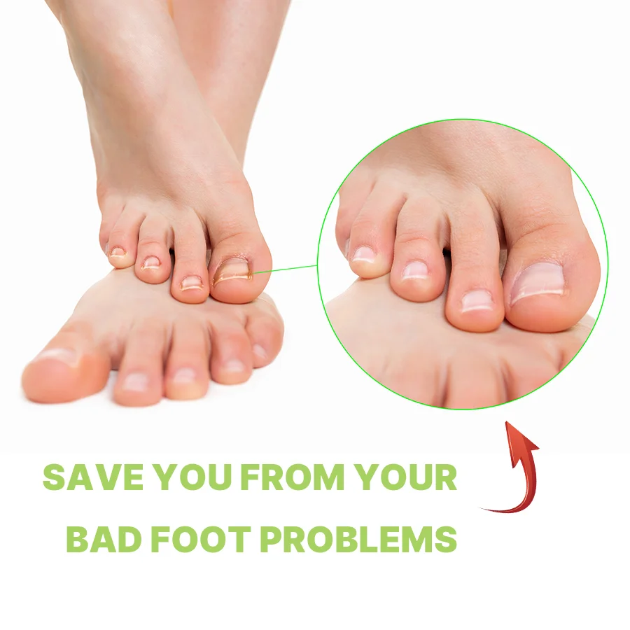 Private Label tea tree oil Foot Cream for Cracked Heels Hand and Foot Moisturizing Urea Cream