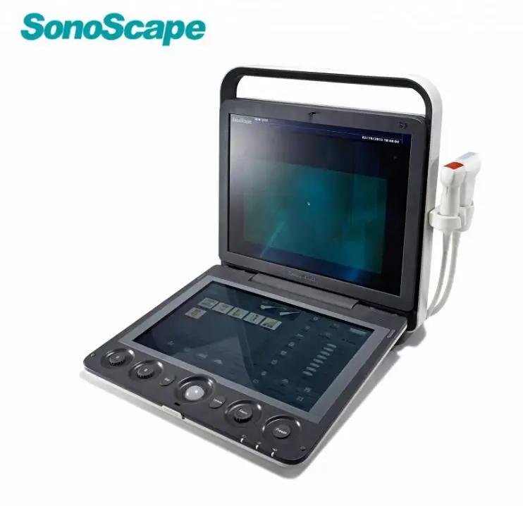 Портативный ультразвуковой допплер Sonoscape S9 сосудистого цвета по хорошей