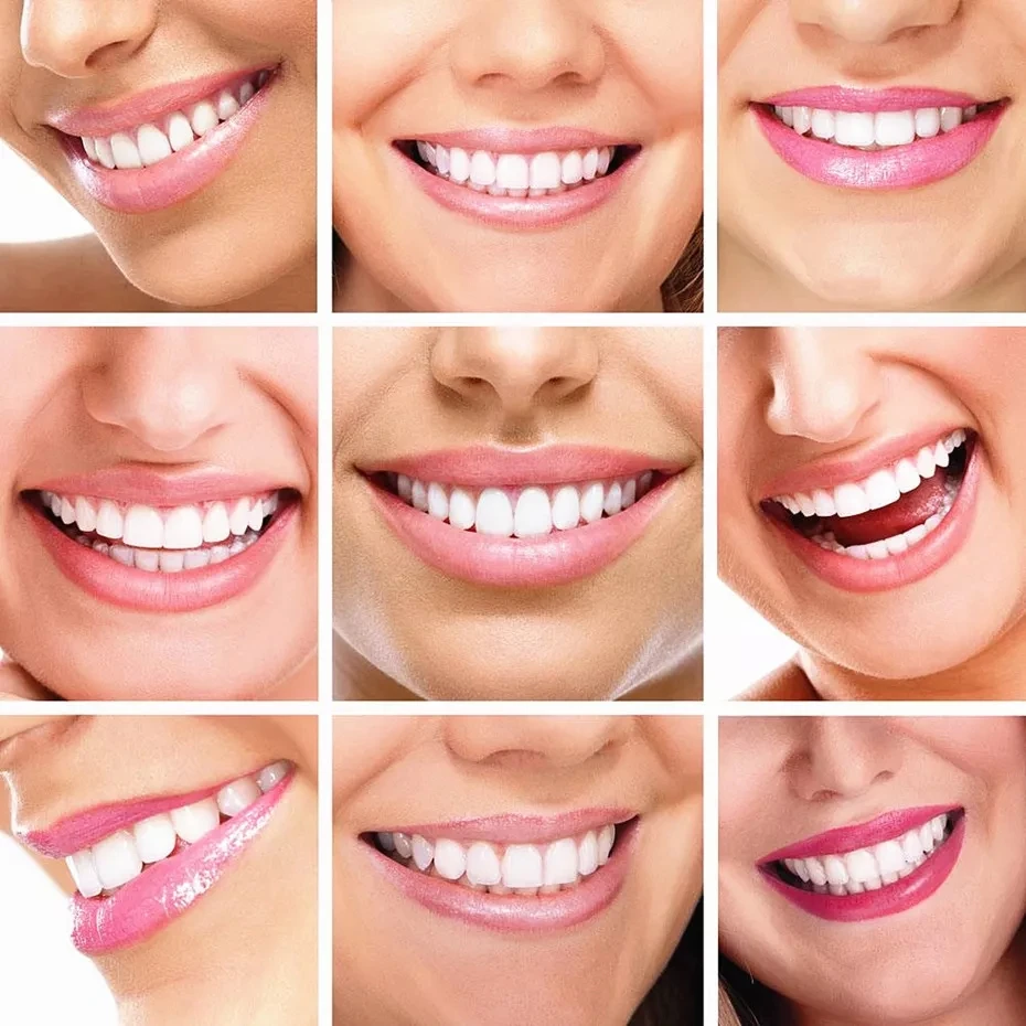 Private Label Gold Dental Whitening Gel 6% HP Wireless LED Light  Teeth Whitening Home Kit