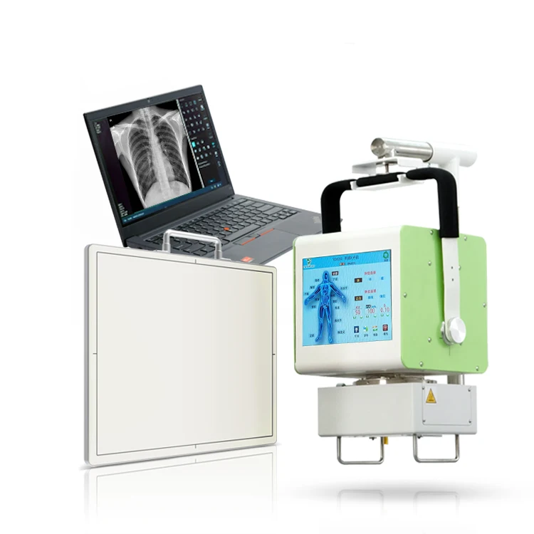 YSX050-C Hot sell Factory 5kw Rayos X digitales Portable X-ray with Best Pirce