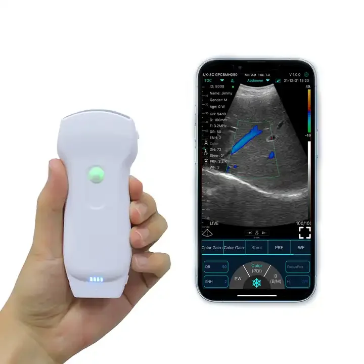MC27 Perfect medical pregnancy usg multi functional wireless ultrasound probe scanner 3 in 1