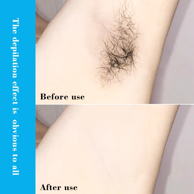 Stop Hair Growth Hair Inhibitor Remover Foam Depilatory Cream Men Women Body Permanent Hair Removal Spray for Men