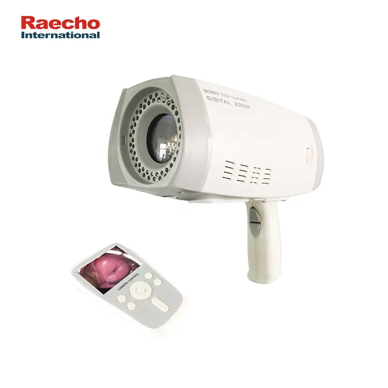 Good Quality Handheld Video Colposcope Digital Gynecology Hospital Convenient