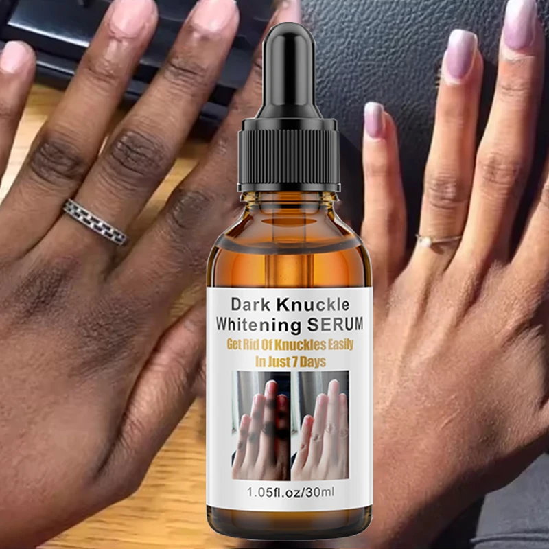 OEM Dark Knuckles Fast Whitening Serum Pigmentation Correctors Hand Knuckle Elbows Knee Intense Stains Remover Serum
