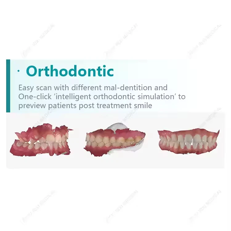 Cheap High Accuracy Manufacturer Price 3D Intraoral Scanner LED Ce Dental Cad Cam Price Oral Therapy Equipments & Accessories 2m