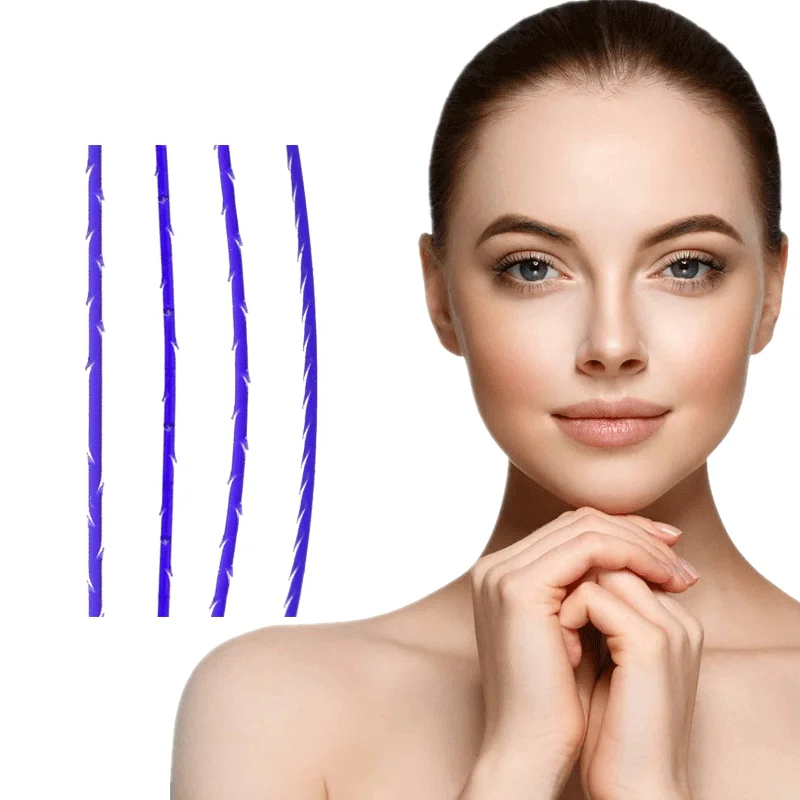 China Supplier skin rejuvenation absorbable v line hilos pdo collagen 4d cog threads