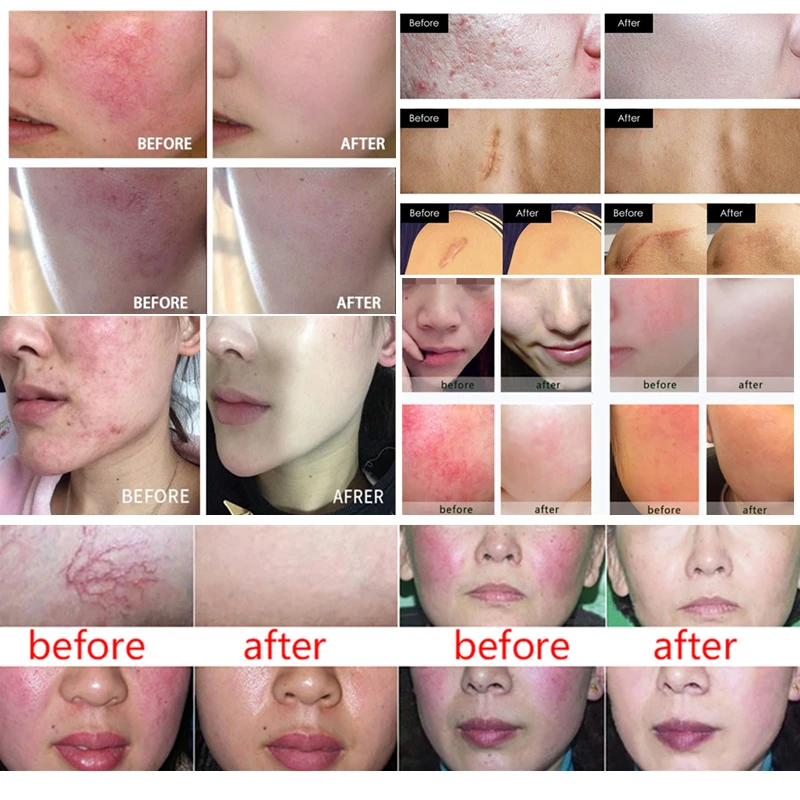 Professional Manufacturer Supply Cosmetic Ingredients FGF7 Powder