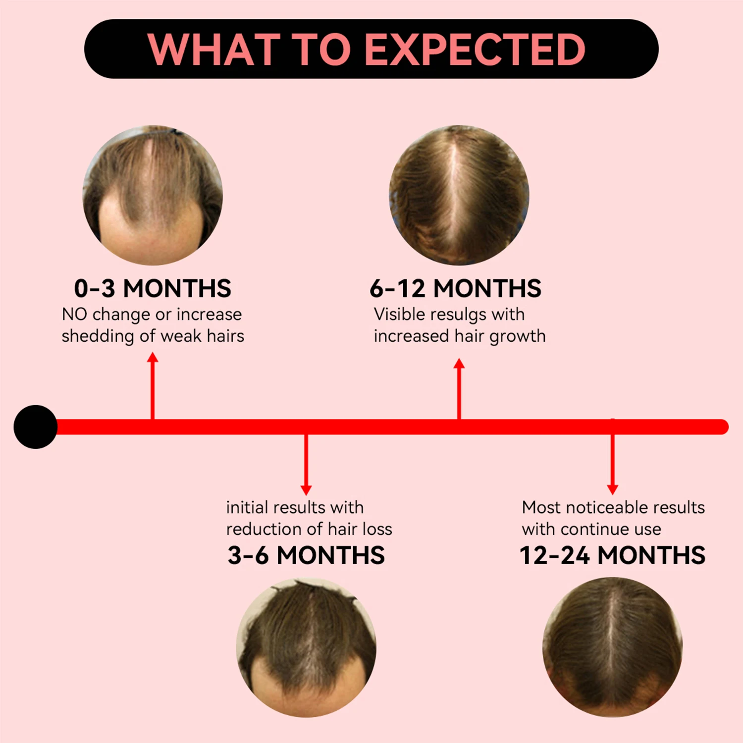 High Power Clinical Grade led Light Therapy Cap red 660nm blue 450nm wireless red light Therapy Cap