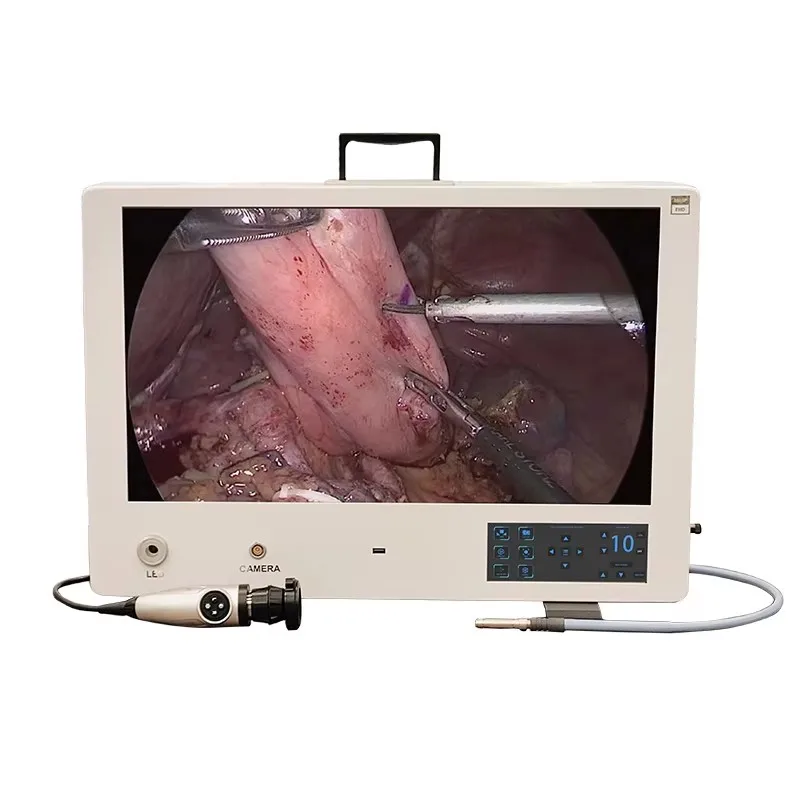 Integrated All in one Telepack Camera System for Arthroscopic Surgeries