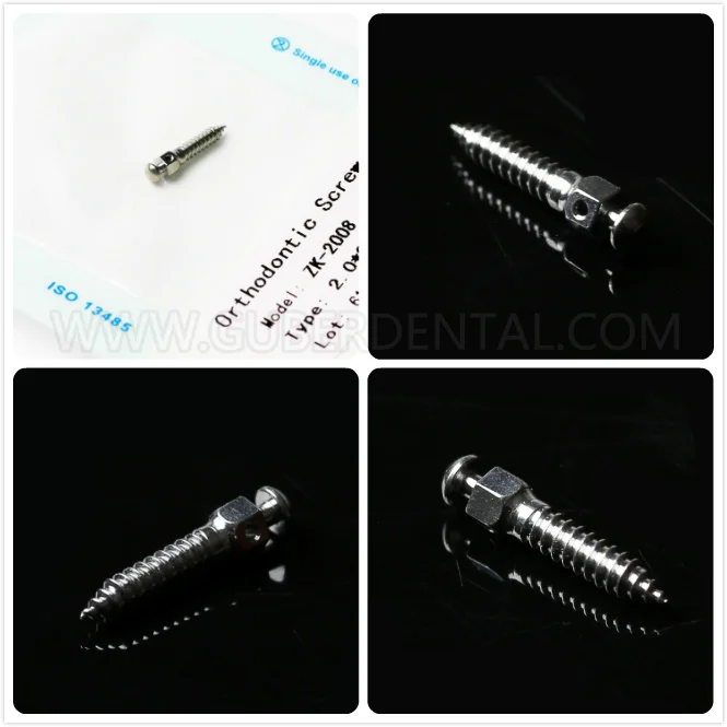 High Quality Dental orthodontic Implants Titanium Mini Screw