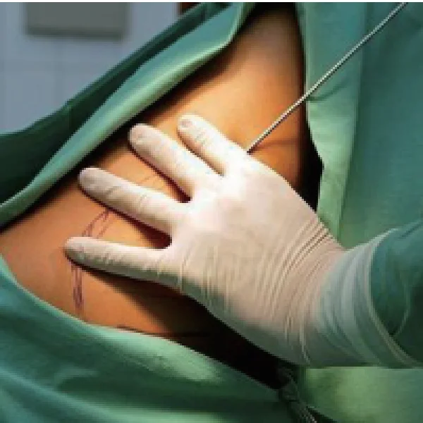 Laserconn slimming 980nm vaser liposuction machine 1470nm laser lipolysis fat removal lipo laser machine