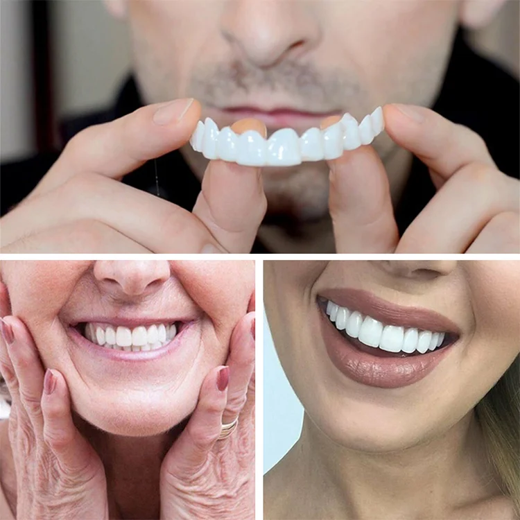 upper and lower false teeth cover white Instant smile false braces on smile veneers for your teeth