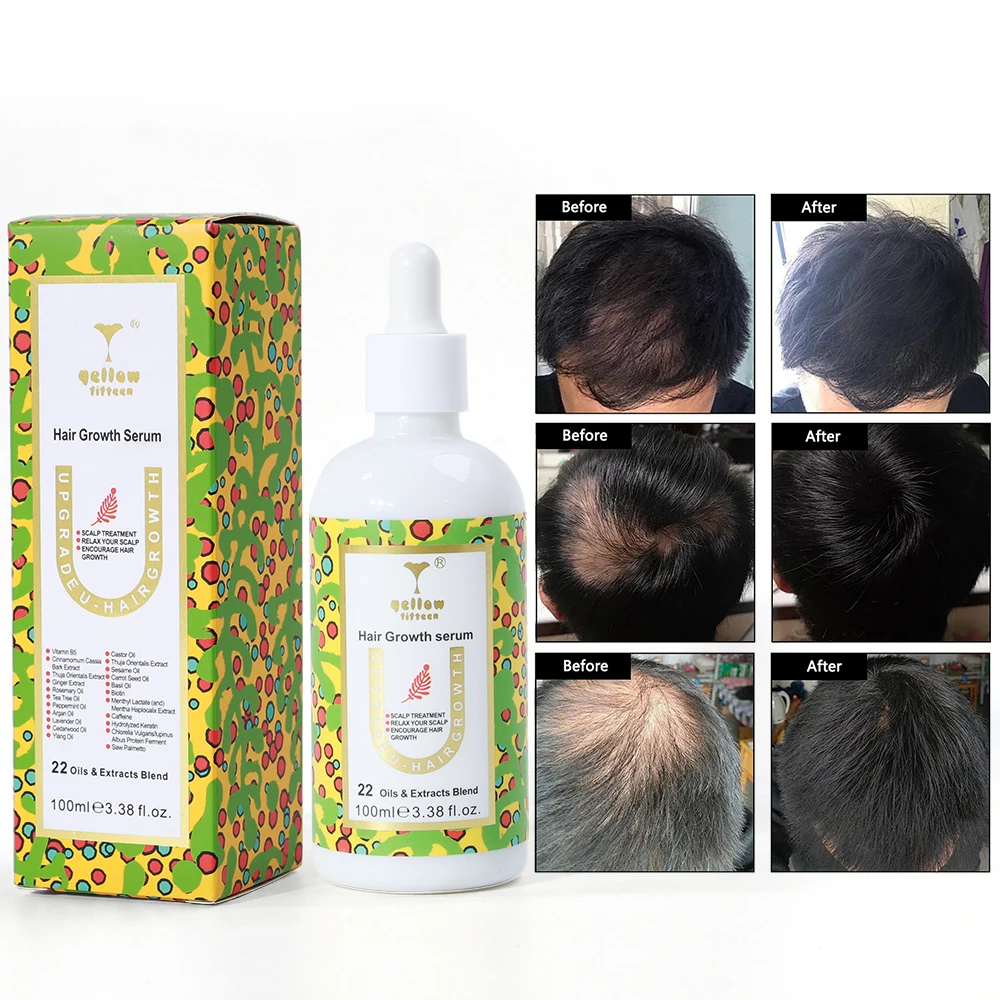 Private Logo Biotin Hair Growth Serum Regrowth Treatment for Scalp Loss Hair Thinning Natural Hair Growth