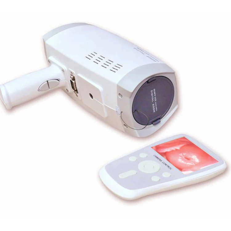 Portable digital video colposcope for gynecological clinical diagnostic equipment