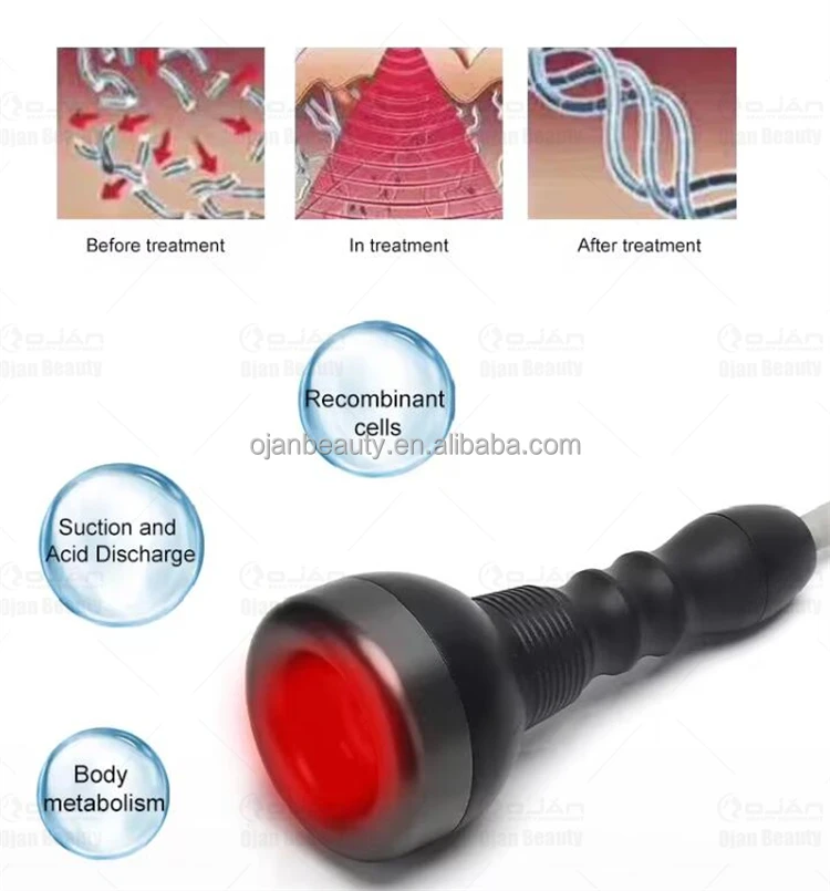 breast enlargerment   (16)