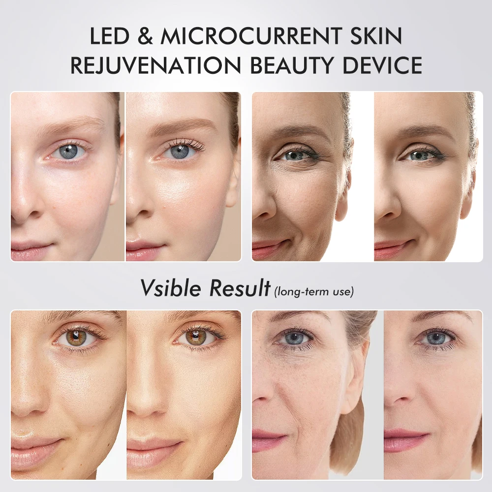 2024 age HFacial Led Red & Blue Acne Spot Treatment Home Use RF Beauty Device Equipment Wand Massager Face Light Therapy Machine