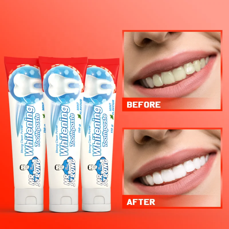 Teeth Brightener and Oral Fresh Toothpaste Whitening