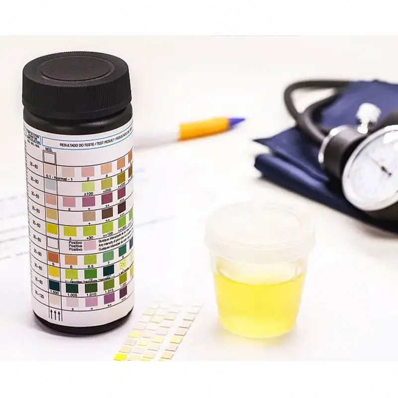 High Quality Supplier Of Urine Strip Analyzer Factory Price Laboratory Reagents
