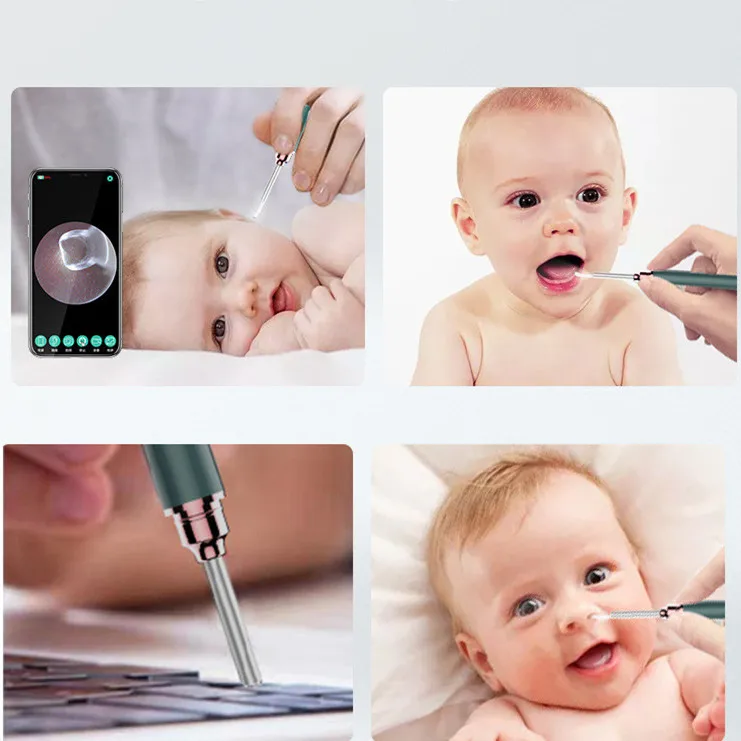 Mini Ear Camera Wifi  Hd 1080p Cleaner with Camera Visual Personal Home Use  Ear Cleaner Intelligent  Ear Wax Remover