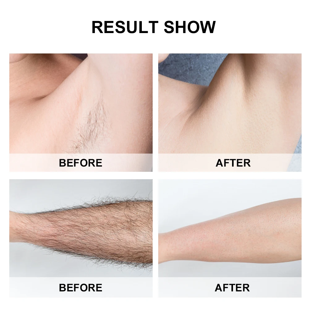 999999 Flashes Epilator Pulse Epilation Ipl Diode Laser Hair Removal portable Home Use Photoepilator Ipl Hair Removal Laser