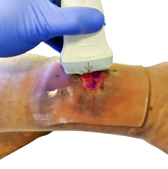 Hydrogel Ultrasound Gel Pad