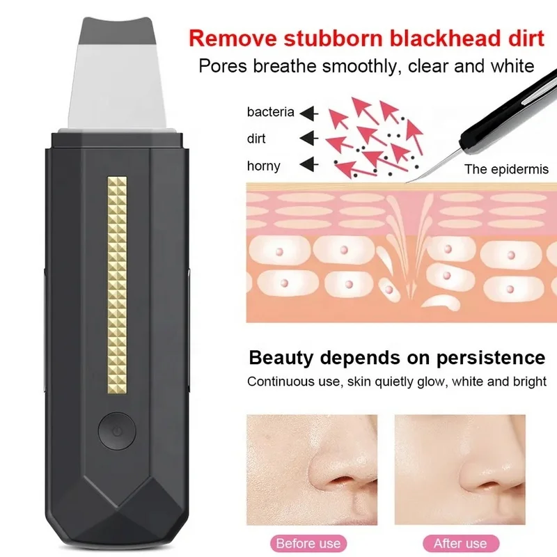 Portable Rechargeable Electric Facial Skin Scrubber Skin Scrubber Ultrasonic Peeling Ultrasonic Facial Skin Scrubber
