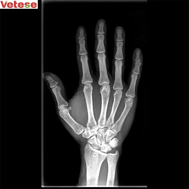 portable x-ray machine for hospital medical x equipments factory x price