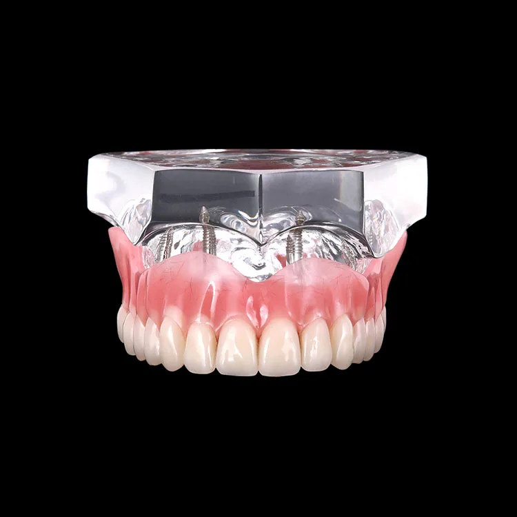teeth model (1).jpg