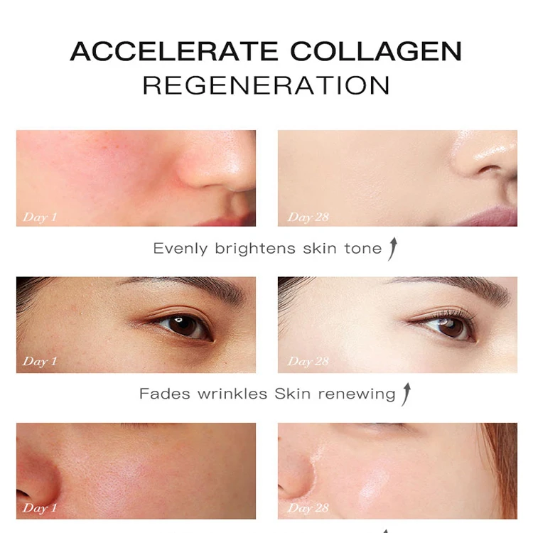 Green Tea Fade acne marks Cream for Whitening Oil Control pore Shrinking Moisturizer Mild Formula Skin Care Cream