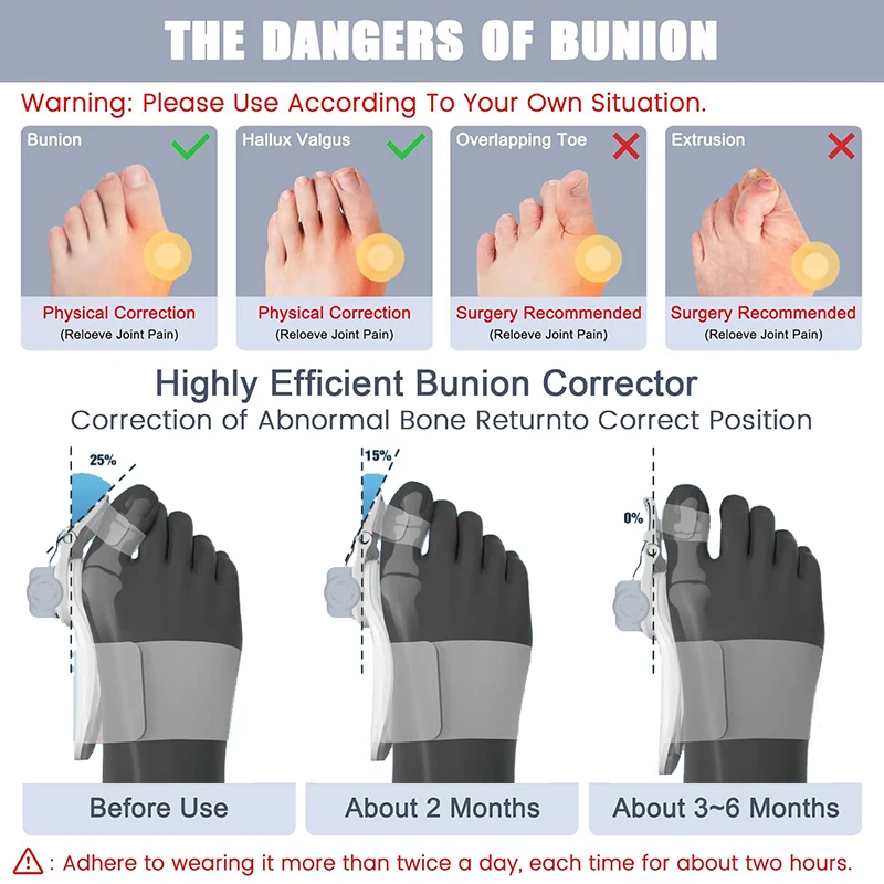 Bunion Corrector for Women Men Big Toe, Adjustable Knob Bunion Splint for Bunion Relief, Orthopedic Toe Straightener