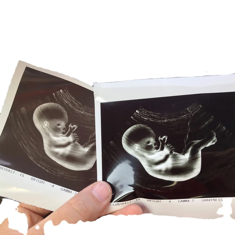 Factory price ultrasound paper High density  110 s medical ultrasound paper Mitsubishi   for hopital