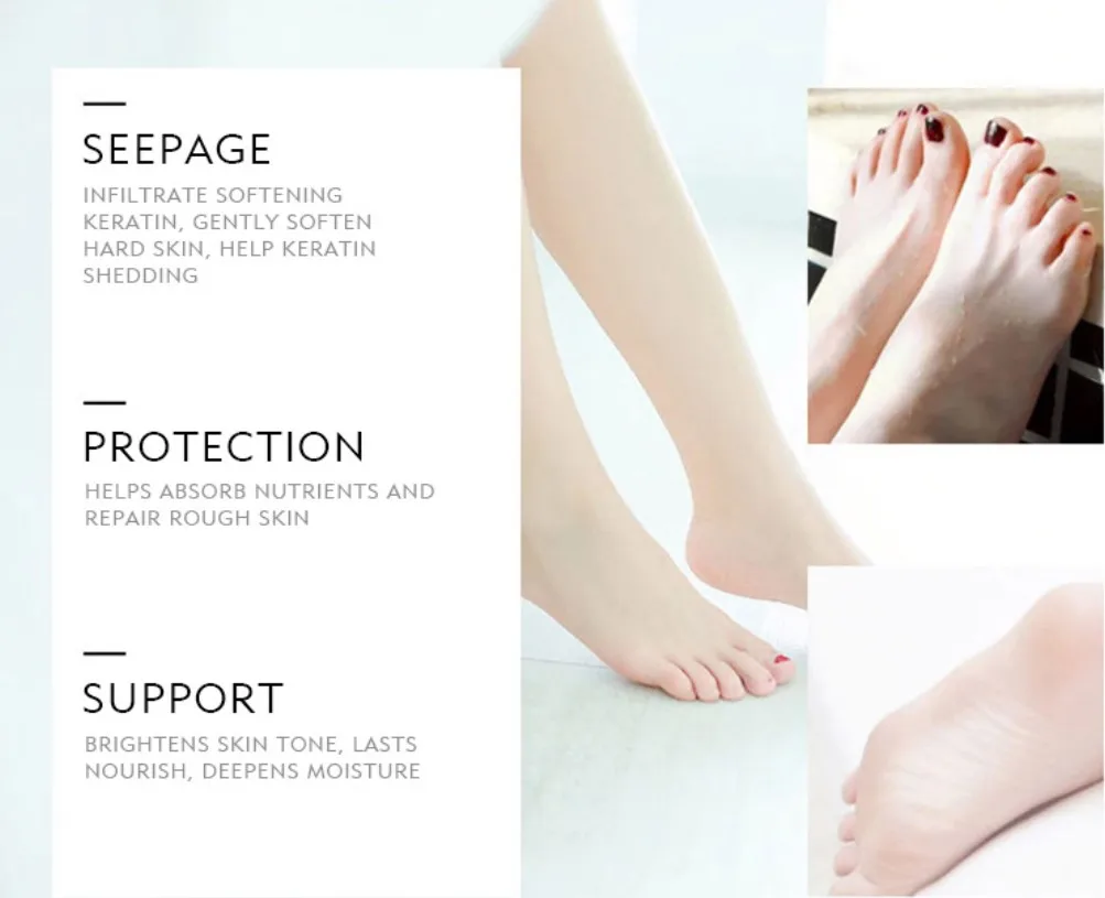 Cracked Heels Dry Hands Skin Softener for Dry Feet Hands Hydrating Smoothing Healthy Feet Moisturizer Dryness Relief Foot Cream