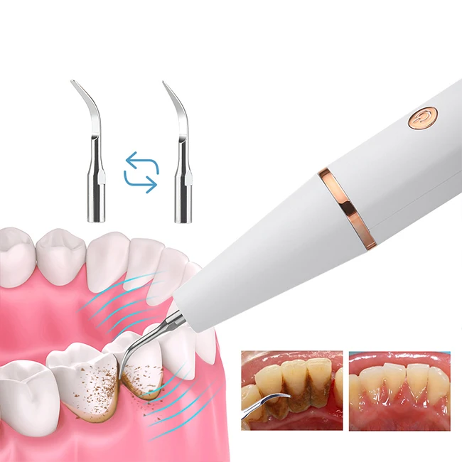 Home Dental calculus Scaling Sonic Plaque Remover Machine Portable Ultrasonic Scaler For Adult