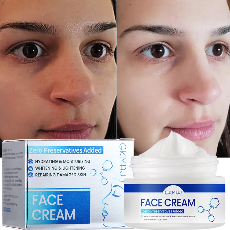 microbial ferment skin care,dark spot acne swelling remove,hydrolyzed collagen anti age wrinkle whitening repairing face cream 8