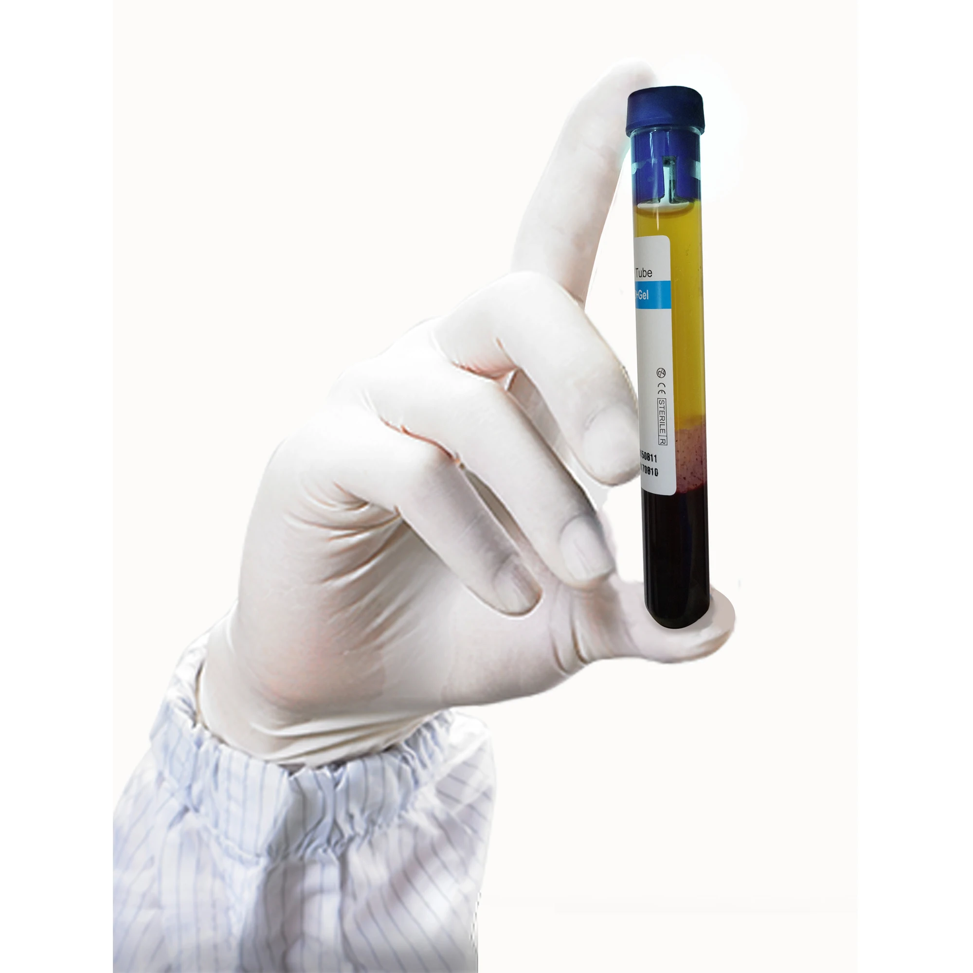 10ml Disposable Medical PRP Tube Sodium Citrate with Gel PRP Kit for Facial