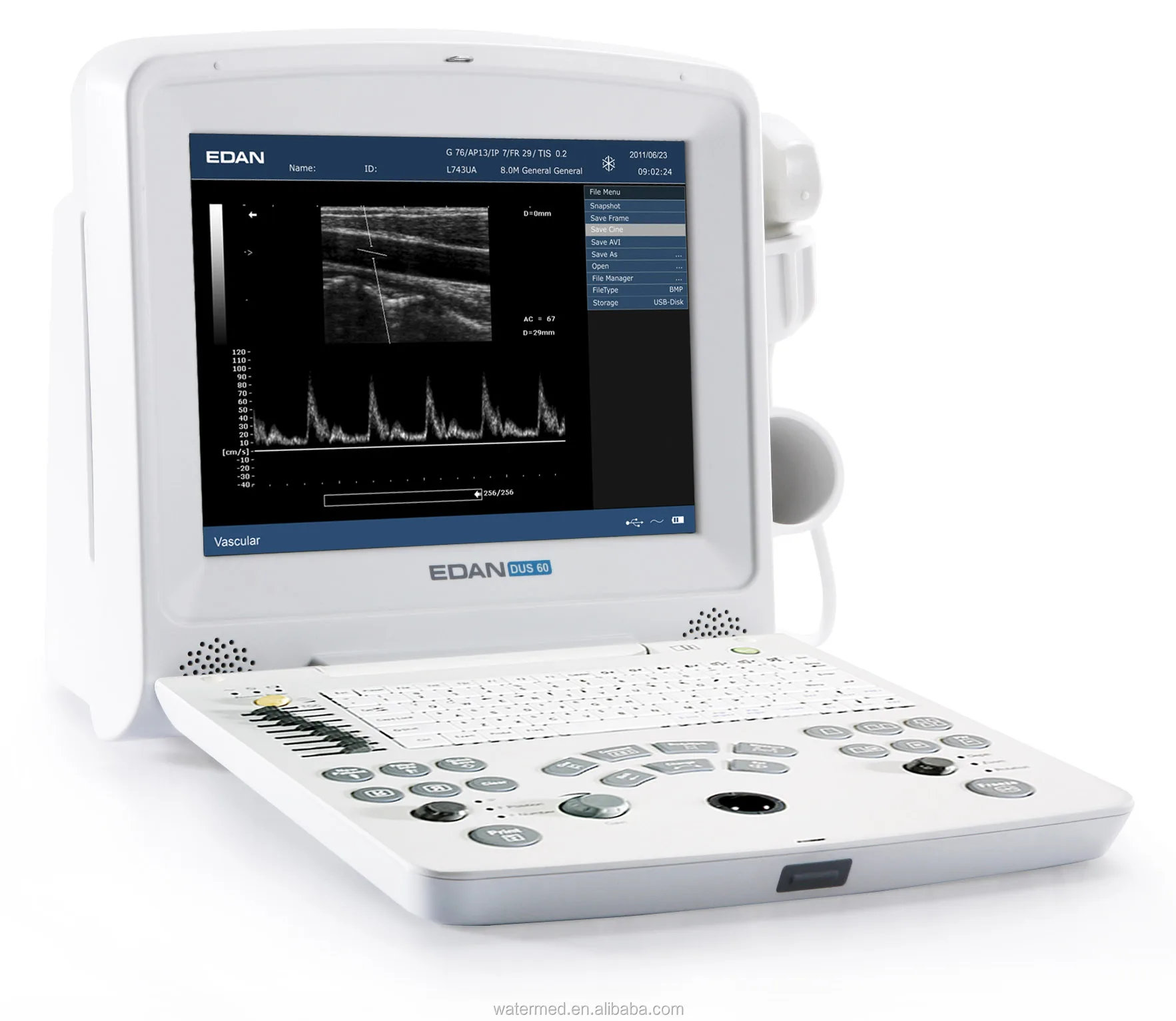 Edan DUS 60 Veterinary Ultrasound Scan Machine
