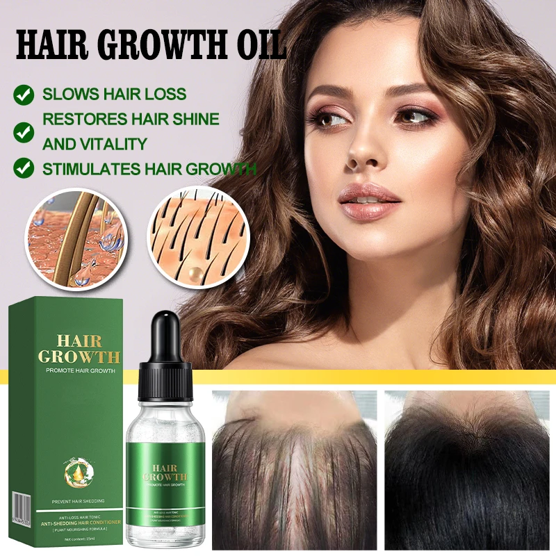 Hair Regrowth Treatment Growth Strengthens Damaged Hair Loss Revitalizes Scalp Hair Care For Men & Women
