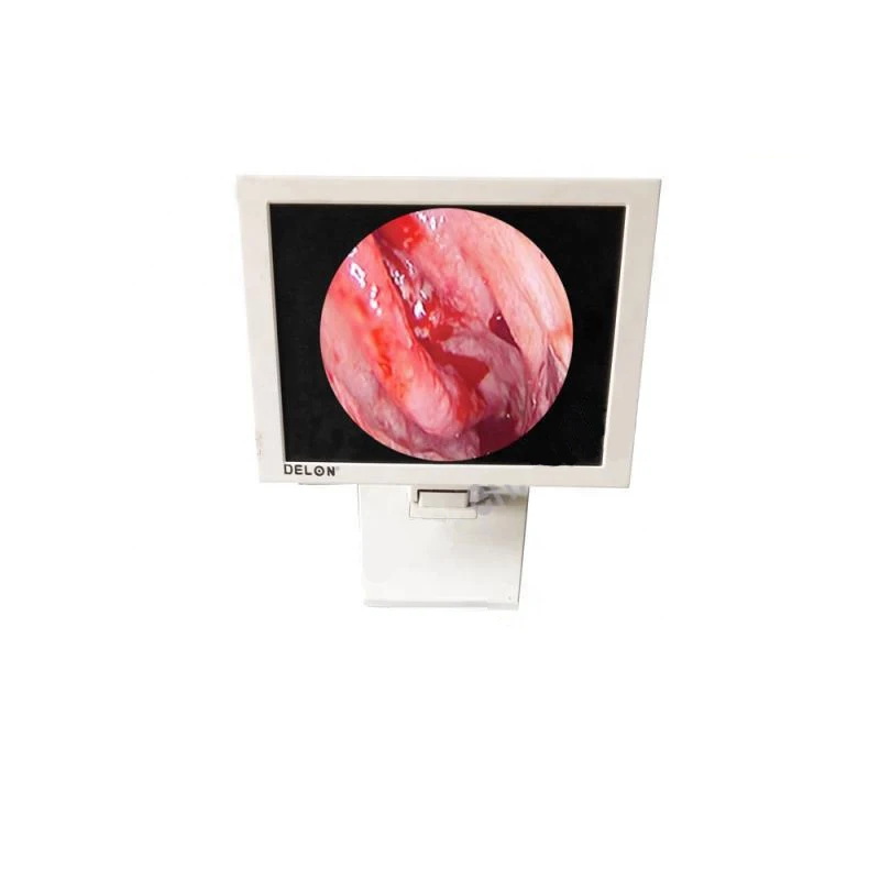 DELON Medical Portable CCD Camera medical delon endoscopy